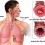 Водещи специалисти препоръчват това лечение при бронхиална астма